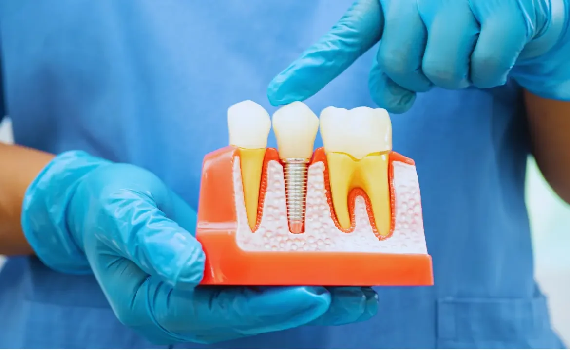 Endodontic Treatment in Dubai