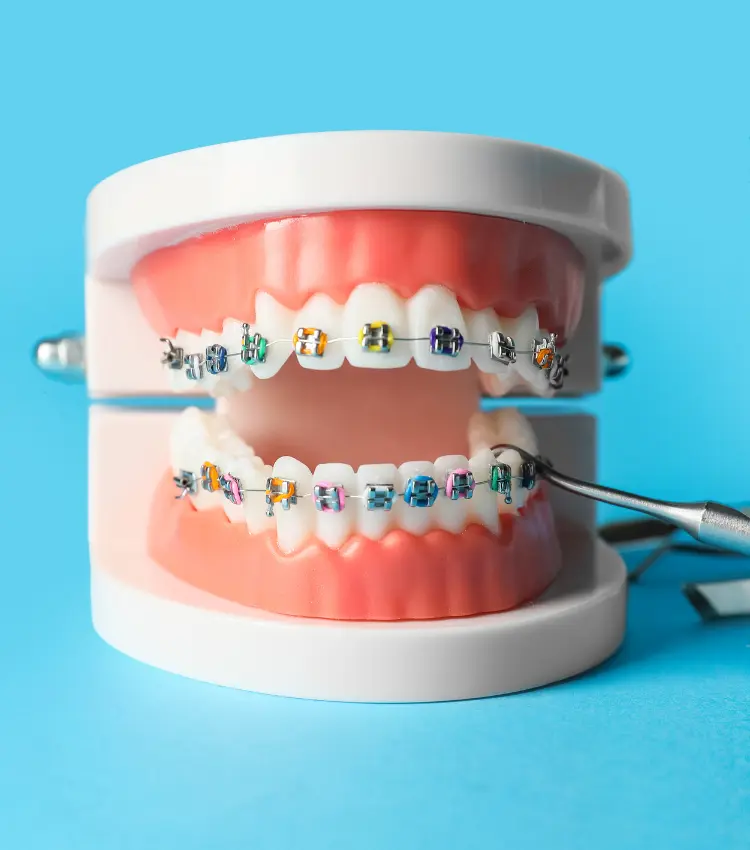 Orthodontics Sample with Surgery Tools